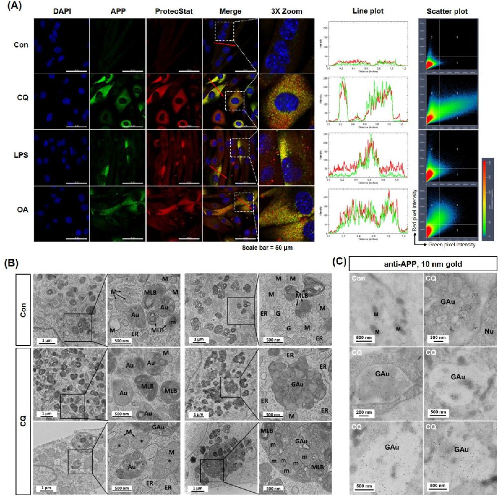 Microscopy Characterization of Chloroquine1